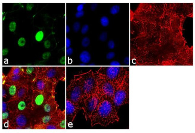 Cyclin D1 Antibody in Immunocytochemistry (ICC/IF)
