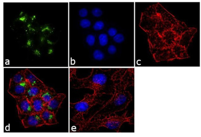 alpha-1 Antitrypsin Antibody in Immunocytochemistry (ICC/IF)