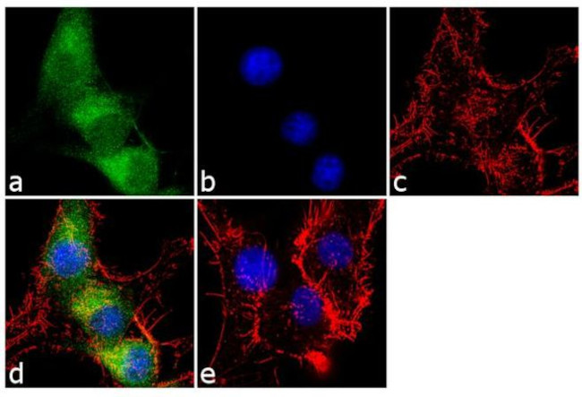 Calretinin Antibody in Immunocytochemistry (ICC/IF)