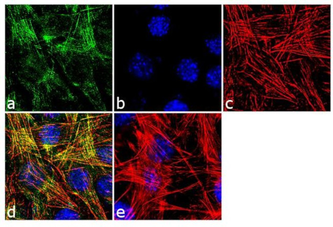 Alpha-Smooth Muscle Actin Antibody in Immunocytochemistry (ICC/IF)