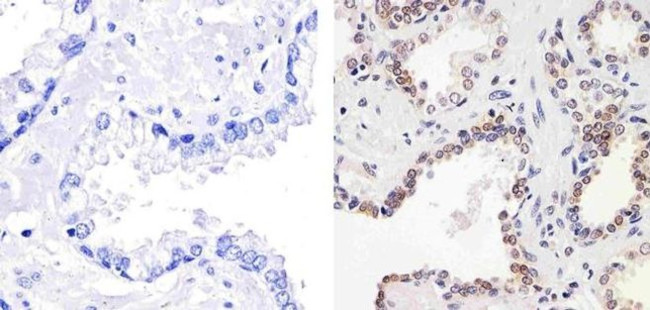 p27 Kip1 Antibody in Immunohistochemistry (Paraffin) (IHC (P))