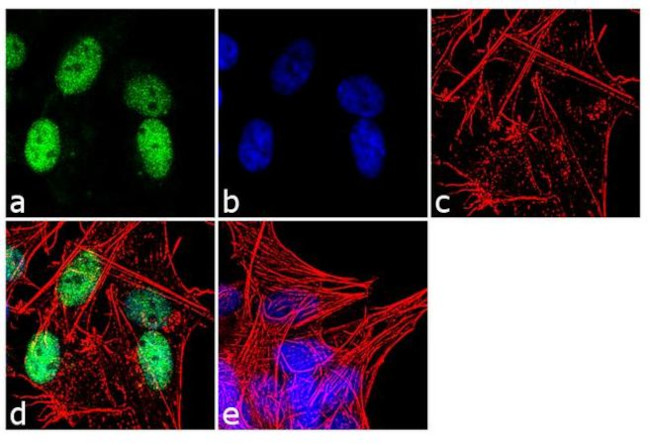alpha Synuclein Antibody in Immunocytochemistry (ICC/IF)