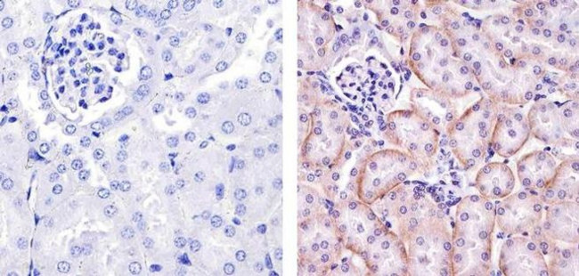 PDGFRA Antibody in Immunohistochemistry (Paraffin) (IHC (P))