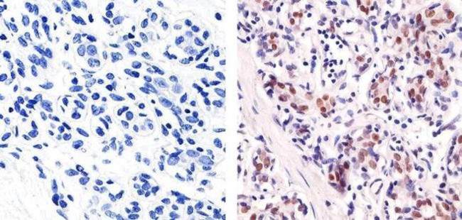 Ki-67 Antibody in Immunohistochemistry (Paraffin) (IHC (P))