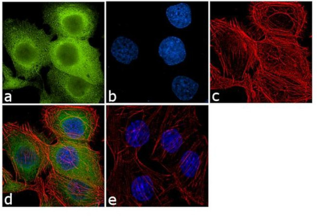 PGP9.5 Antibody in Immunocytochemistry (ICC/IF)