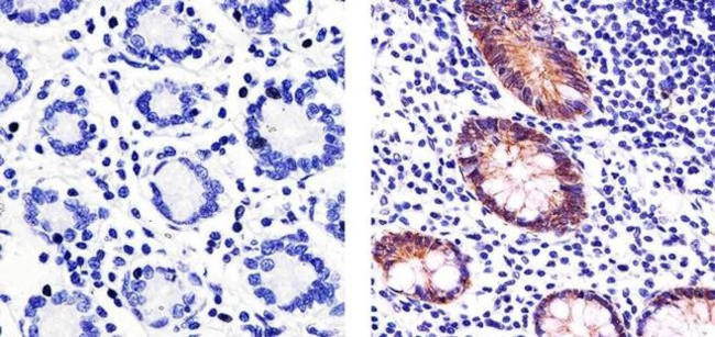 Claudin 3 Antibody in Immunohistochemistry (Paraffin) (IHC (P))