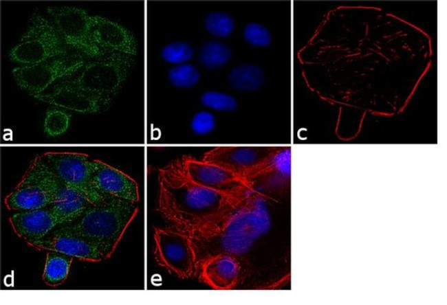 WT1 Antibody in Immunocytochemistry (ICC/IF)