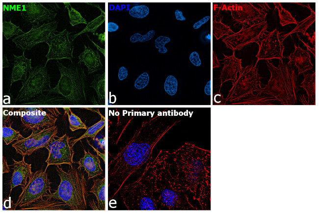 NME1 Antibody in Immunocytochemistry (ICC/IF)