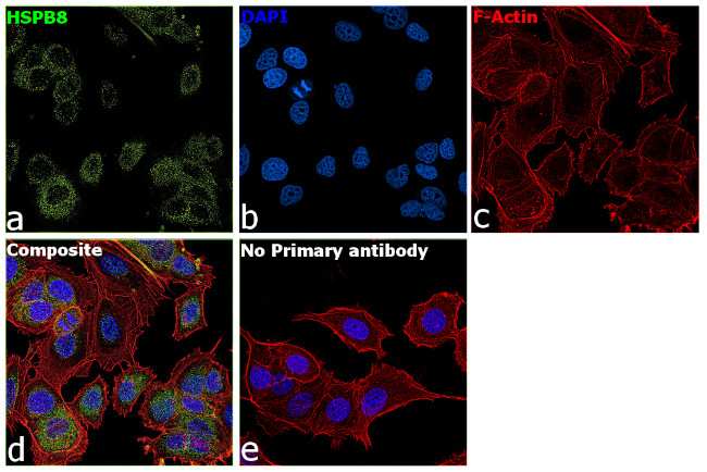 HSPB8 Antibody in Immunocytochemistry (ICC/IF)