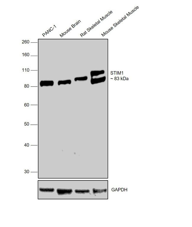 STIM1 Antibody in Western Blot (WB)