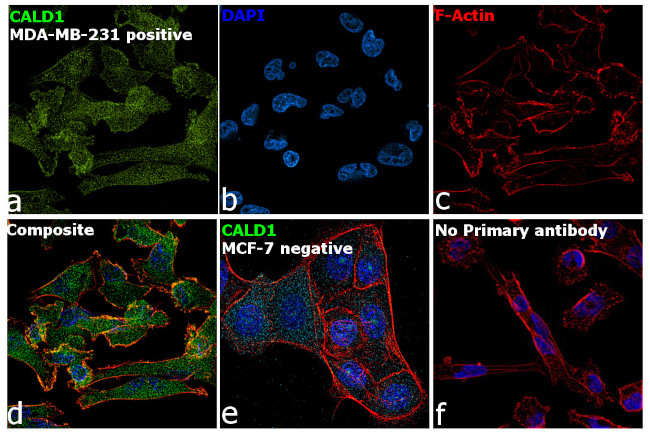 Caldesmon Antibody in Immunocytochemistry (ICC/IF)
