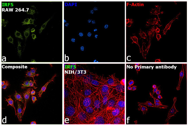 IRF5 Antibody in Immunocytochemistry (ICC/IF)