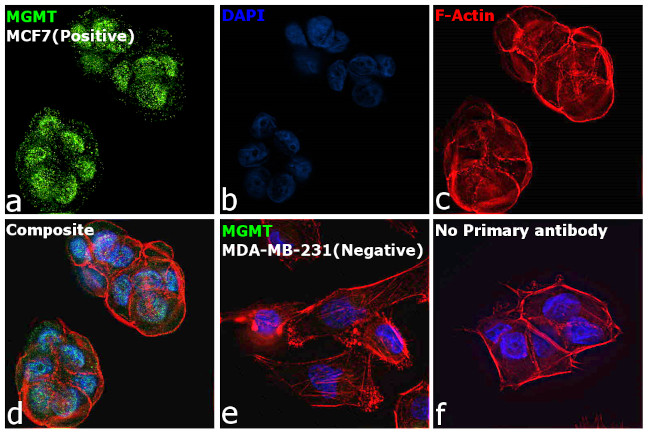 MGMT Antibody in Immunocytochemistry (ICC/IF)