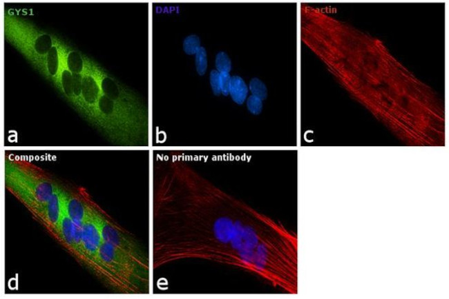 GYS1 Antibody in Immunocytochemistry (ICC/IF)