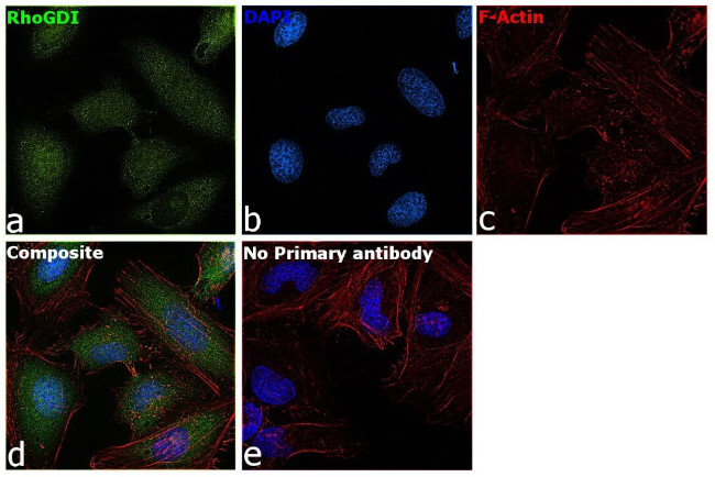 RhoGDI Antibody in Immunocytochemistry (ICC/IF)