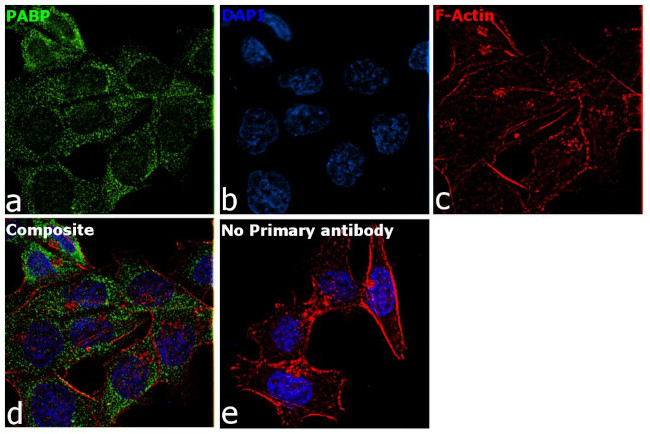 PABP Antibody in Immunocytochemistry (ICC/IF)