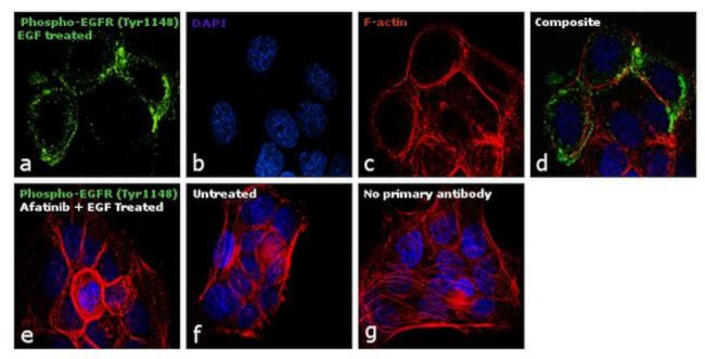 Phospho-EGFR (Tyr1148) Antibody in Immunocytochemistry (ICC/IF)