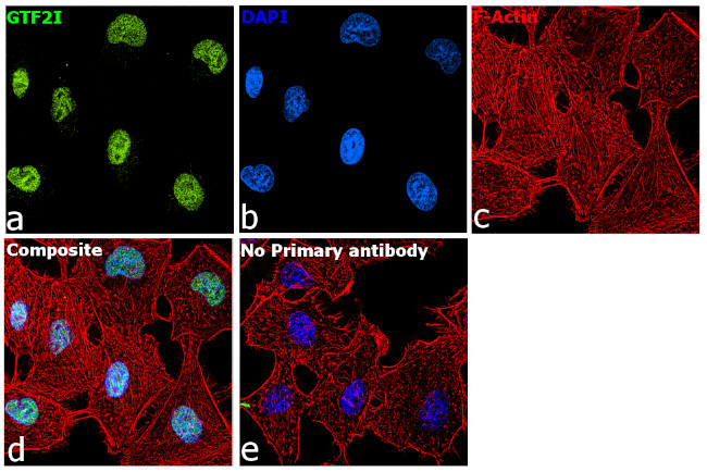 GTF2I Antibody in Immunocytochemistry (ICC/IF)