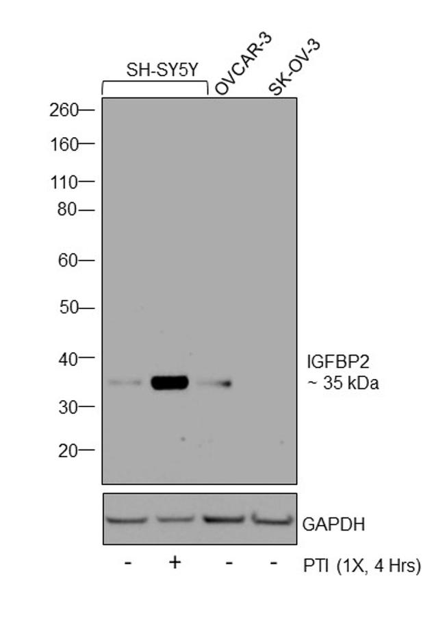 IGFBP2 Antibody in Western Blot (WB)