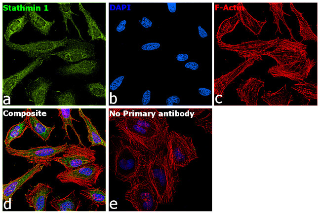 Stathmin 1 Antibody in Immunocytochemistry (ICC/IF)
