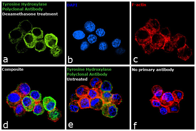 Tyrosine Hydroxylase Antibody in Immunocytochemistry (ICC/IF)