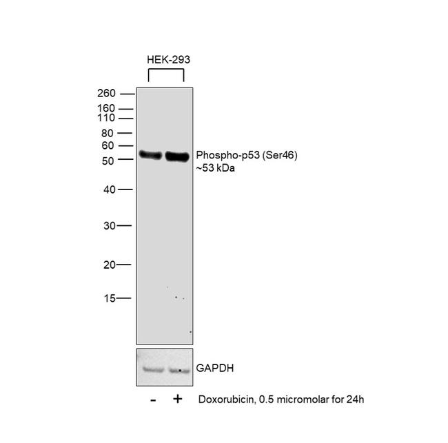 Phospho-p53 (Ser46) Antibody in Western Blot (WB)