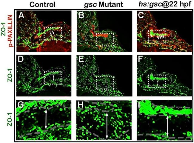 Phospho-Paxillin (Tyr118) Antibody in Immunohistochemistry (IHC)