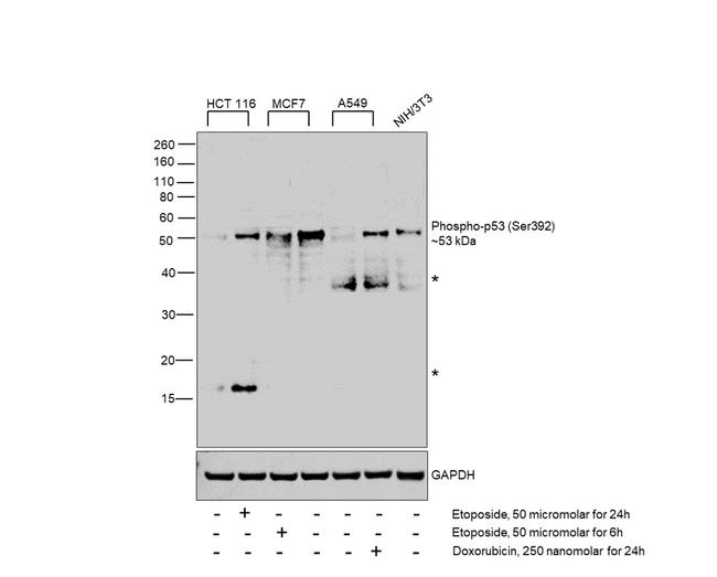 Phospho-p53 (Ser392) Antibody in Western Blot (WB)