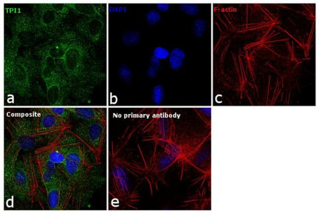 TPI1 Antibody in Immunocytochemistry (ICC/IF)