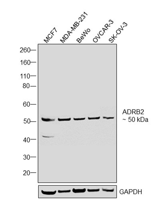 beta-2 Adrenergic Receptor Antibody in Western Blot (WB)