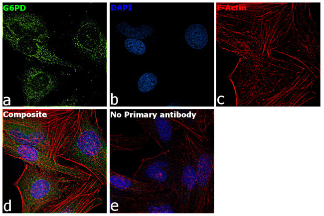 G6PD Antibody in Immunocytochemistry (ICC/IF)