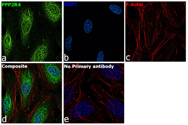 PPP2R4 Antibody in Immunocytochemistry (ICC/IF)