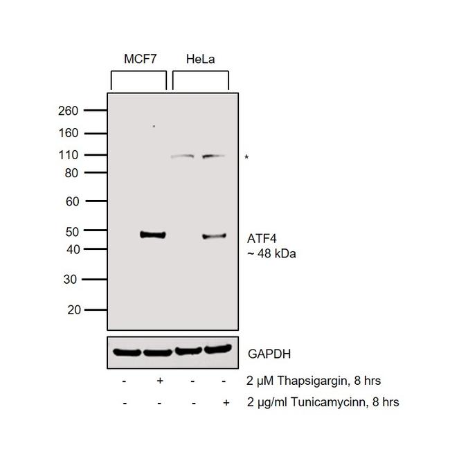 ATF4 Antibody in Western Blot (WB)