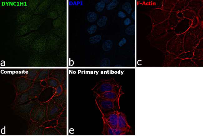 UBC9 Antibody in Immunocytochemistry (ICC/IF)
