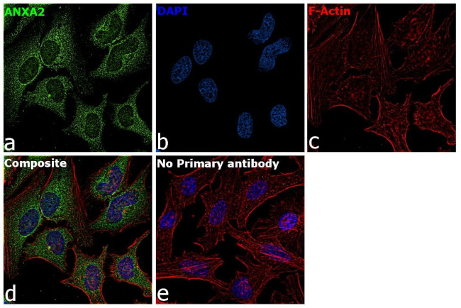 Annexin A2 Antibody in Immunocytochemistry (ICC/IF)