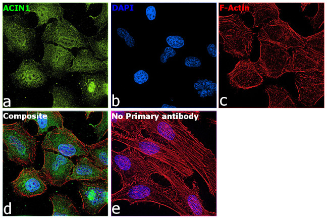 Acinus Antibody in Immunocytochemistry (ICC/IF)
