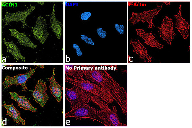Acinus Antibody in Immunocytochemistry (ICC/IF)