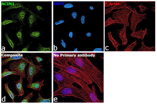 Acinus Antibody in Immunocytochemistry (ICC/IF)