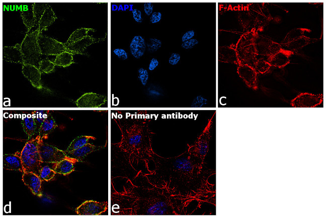 NUMB Antibody in Immunocytochemistry (ICC/IF)