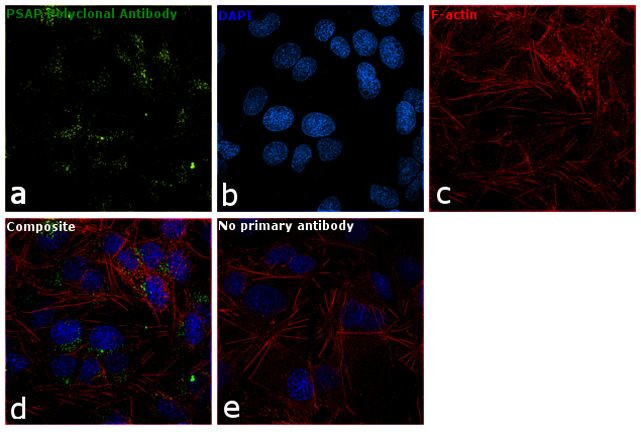 PSAP Antibody in Immunocytochemistry (ICC/IF)