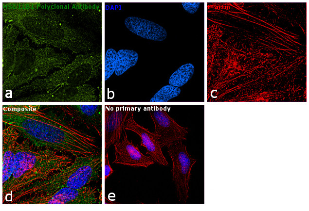HSD11B1 Antibody in Immunocytochemistry (ICC/IF)