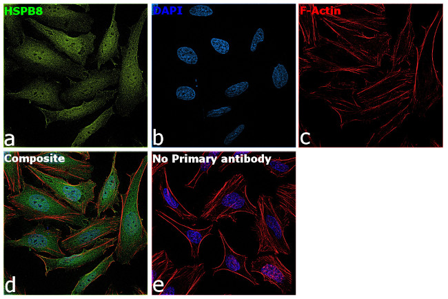HSPB8 Antibody in Immunocytochemistry (ICC/IF)