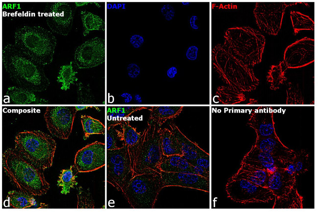 ARF1 Antibody in Immunocytochemistry (ICC/IF)