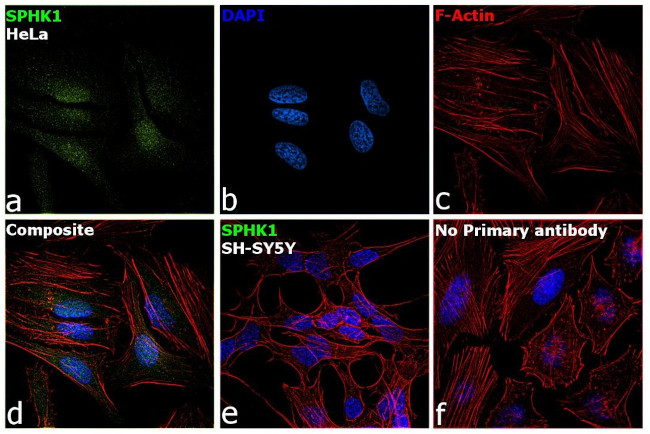 SPHK1 Antibody in Immunocytochemistry (ICC/IF)
