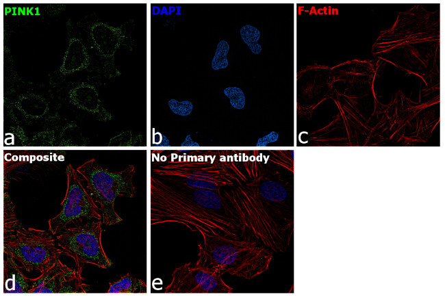 PINK1 Antibody in Immunocytochemistry (ICC/IF)
