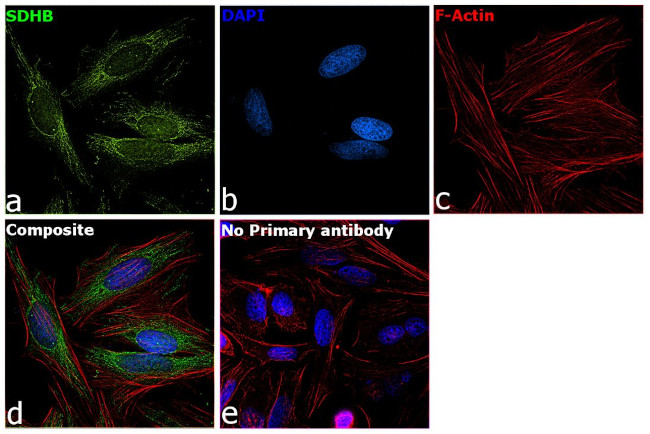 SDHB Antibody in Immunocytochemistry (ICC/IF)