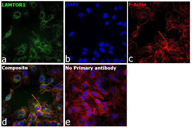 LAMTOR1 Antibody in Immunocytochemistry (ICC/IF)