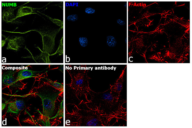 NUMB Antibody in Immunocytochemistry (ICC/IF)