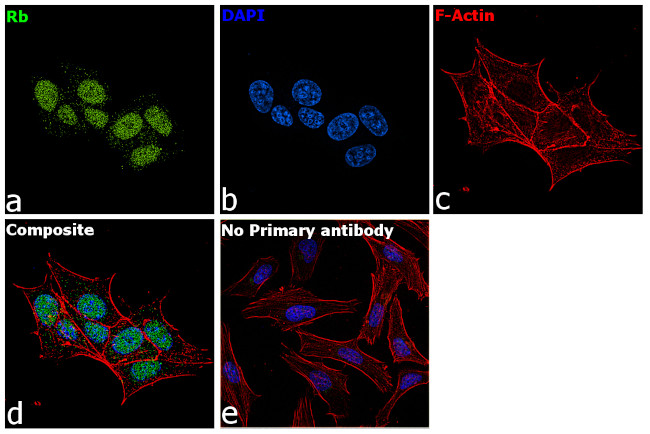 Rb Antibody in Immunocytochemistry (ICC/IF)