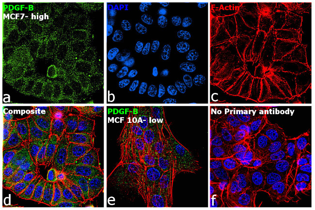 PDGF-B Antibody in Immunocytochemistry (ICC/IF)